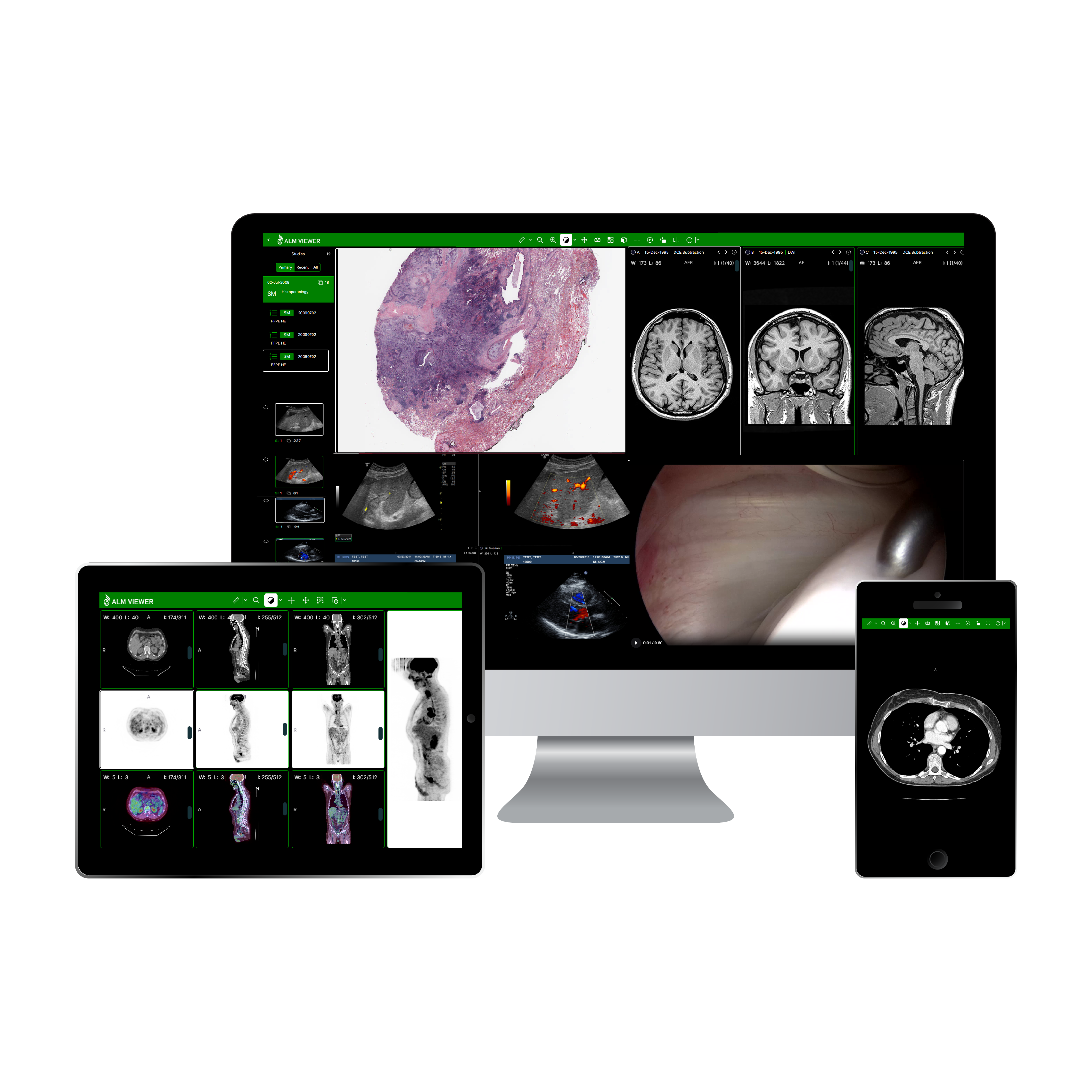 ALM DICOM Viewer displaying radiology images on desktop, tablet, and mobile devices.
