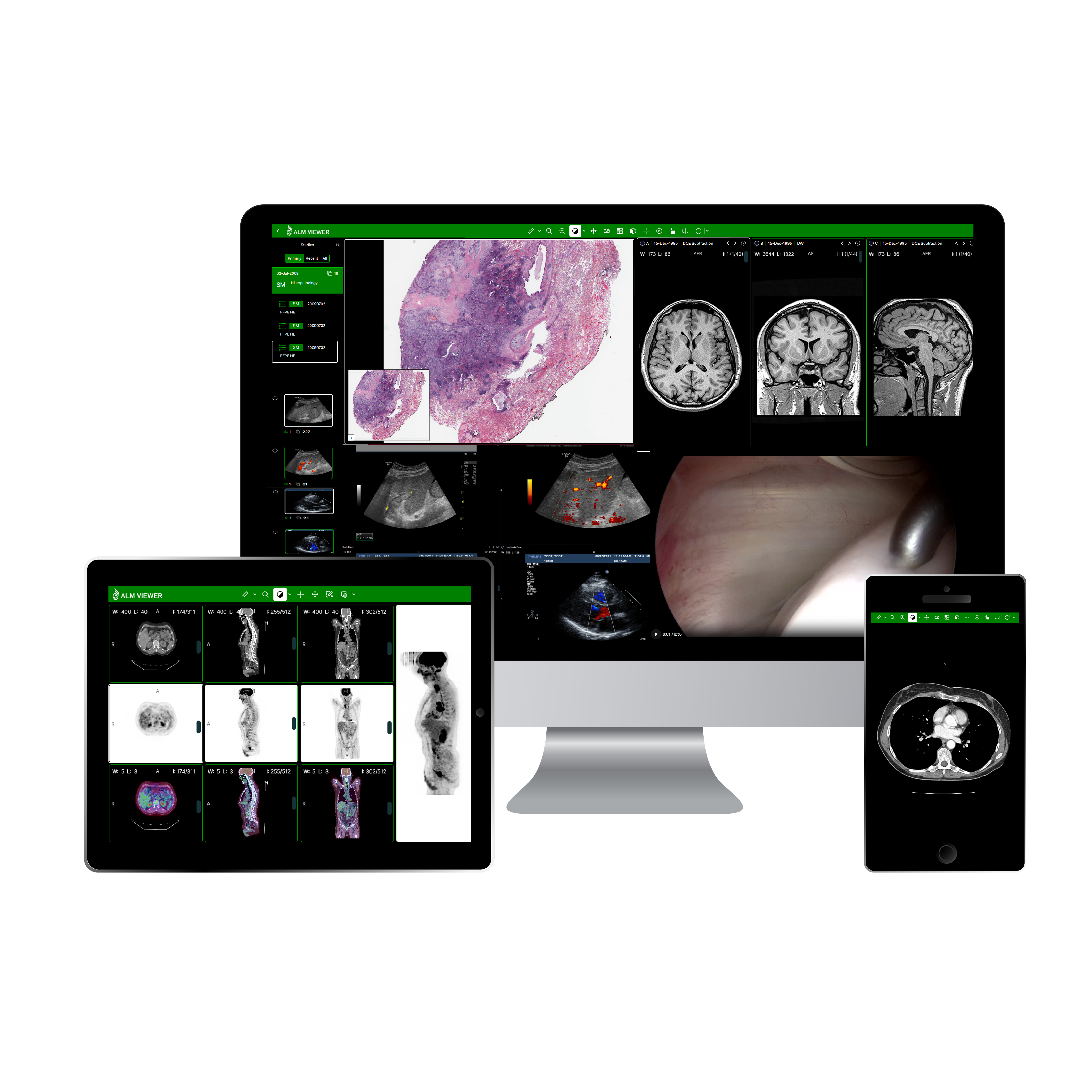 ALM DICOM Viewer displaying radiology images on desktop, tablet, and mobile devices.