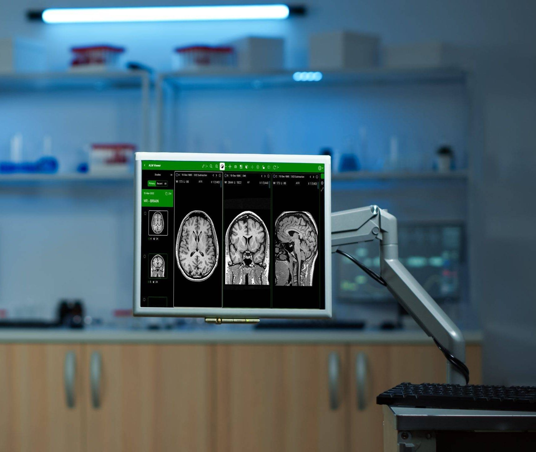 ALM DICOM Viewer is an Advanced Web-Based DICOM Viewer for Radiology and PACS Servers