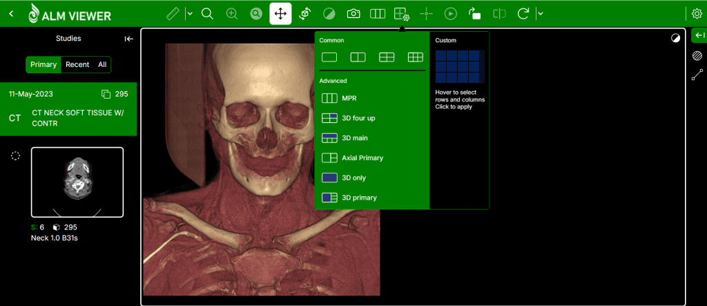 ALM DICOM Viewer Cloud Model