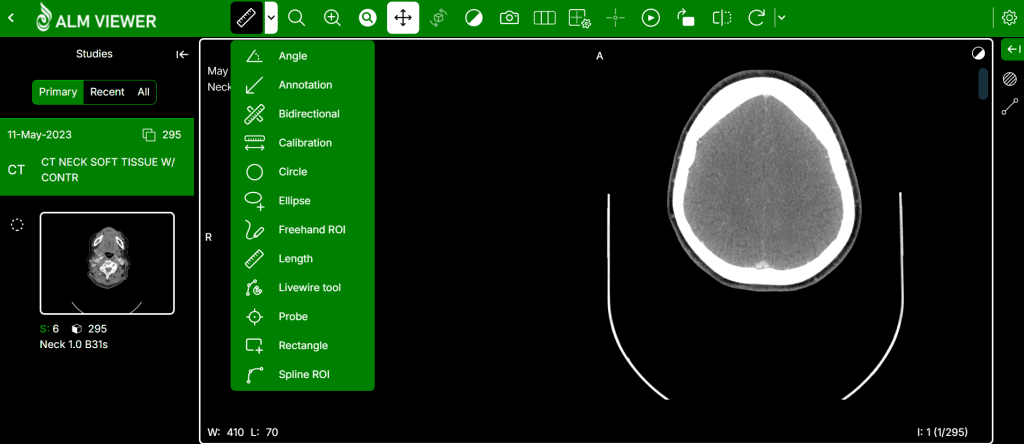 ALM DICOM Viewer Measurement tools demonstration