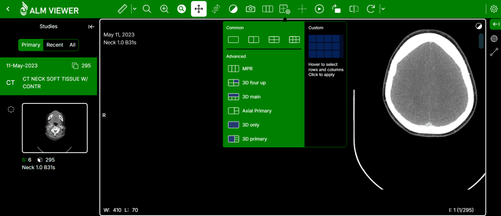 ALM DICOM Viewer Cloud Model