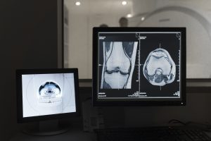 CT-scan-radiant-radiology