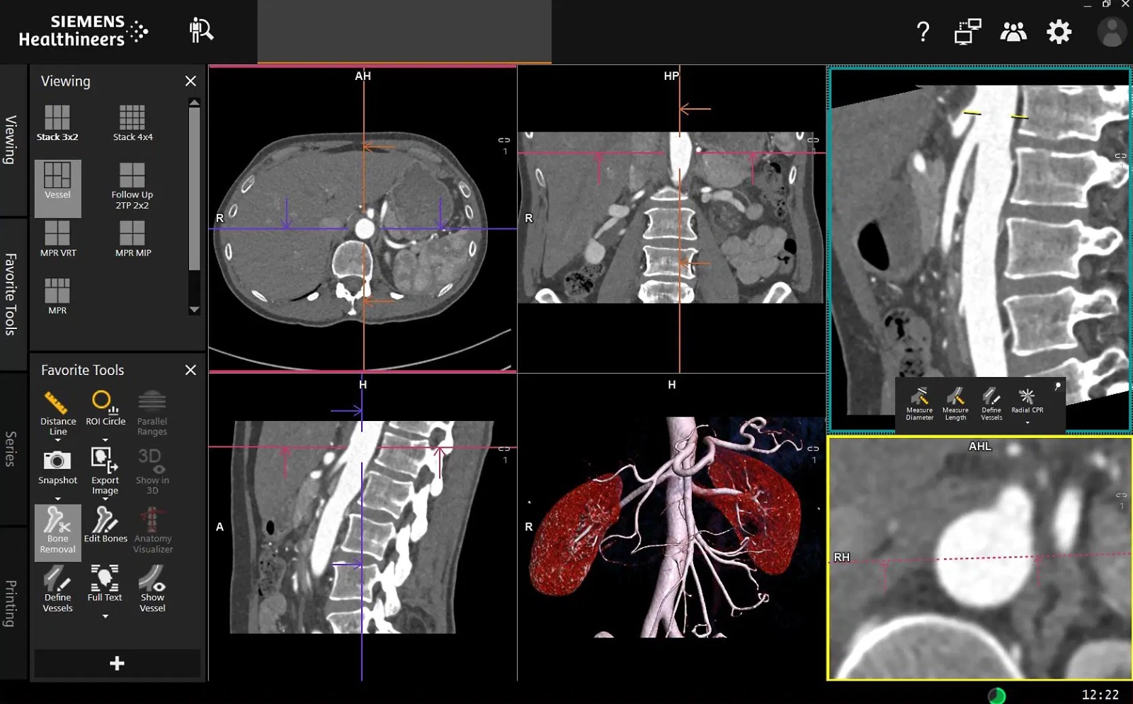 CT-Scan-Viewer