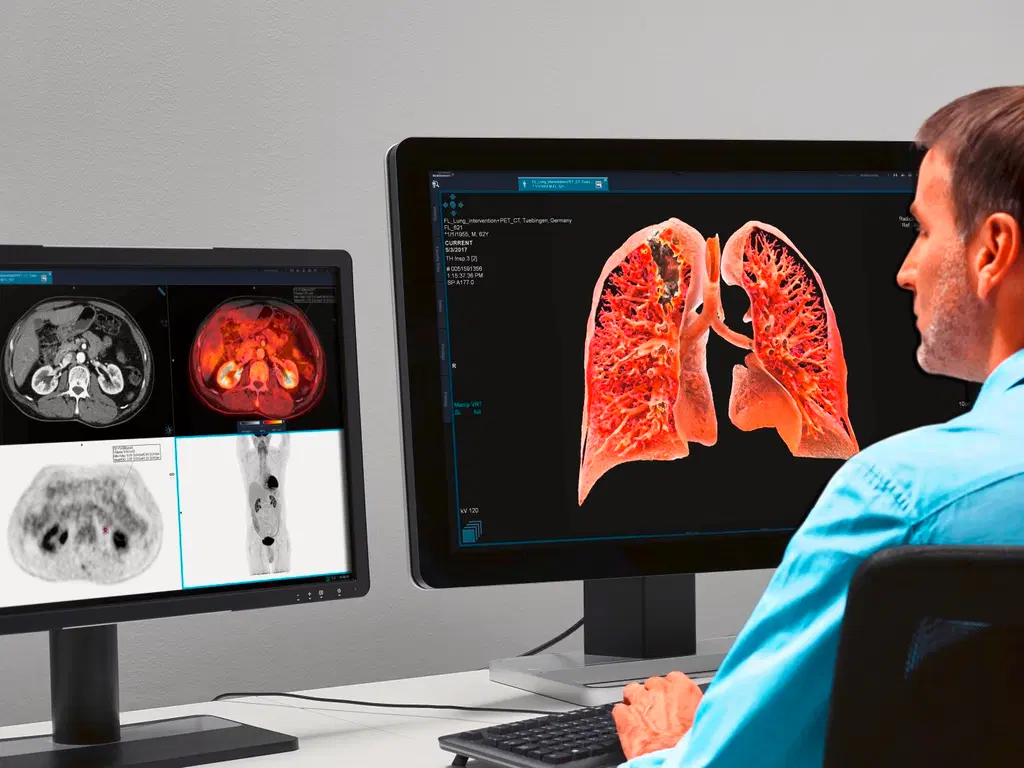 PACS-Medical-Imaging
