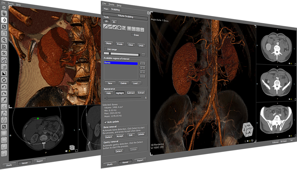 Why ALM Viewer Outperforms Other DICOM Viewers for Windows 7