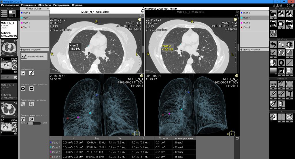 DICOM viewer for Windows 7
