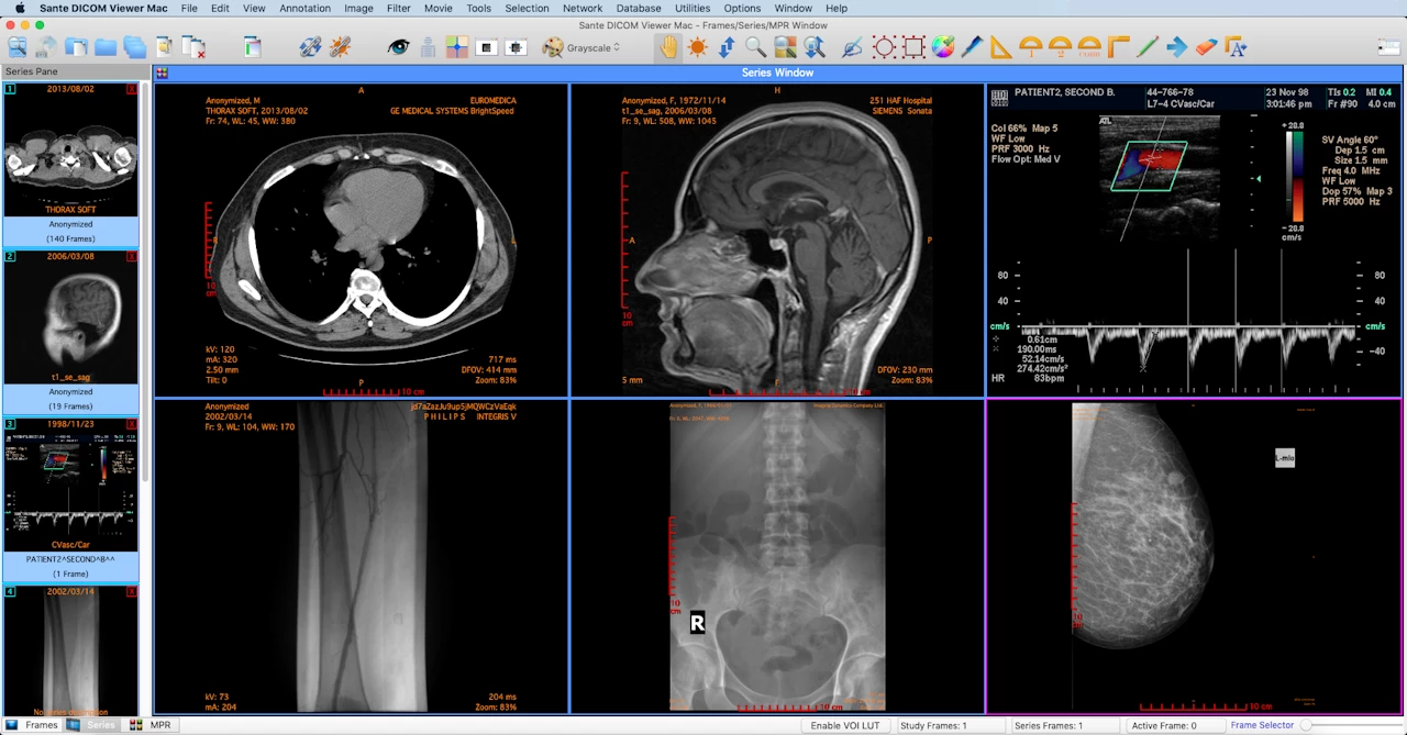 best DICOM viewer for Windows 7