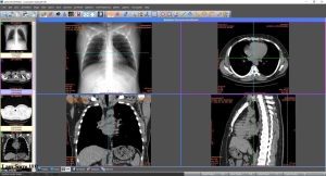 PACS and DICOM 