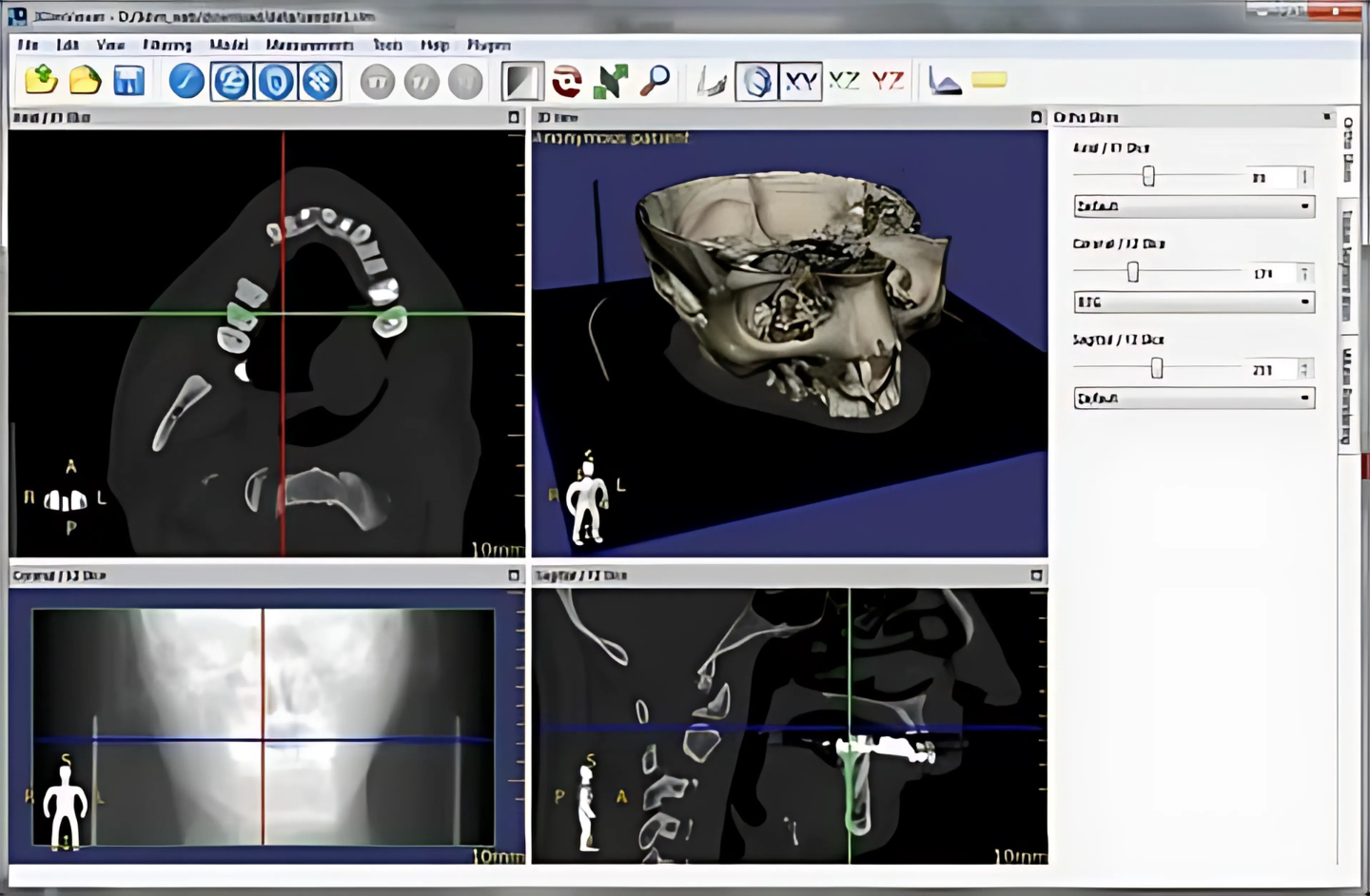 3D DICOM medical model visualization in Windows DICOM viewer tool