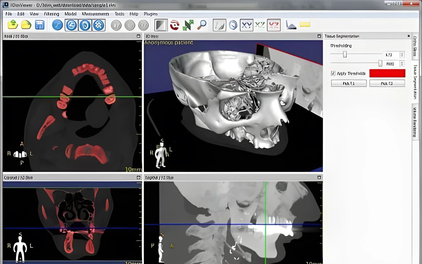  3D DICOM Model Images Remotely
