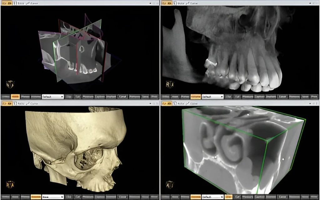 3D DICOM Model Images FOR Windows tool