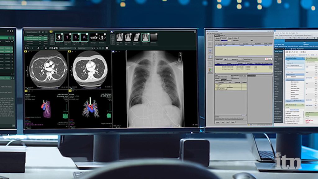 X-Ray-Viewer-and-PACS-Solutions