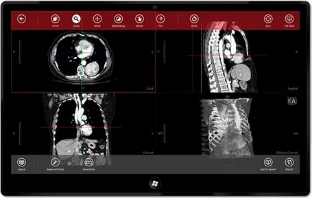 ALM DICOM Viewer Hybrid Model 2