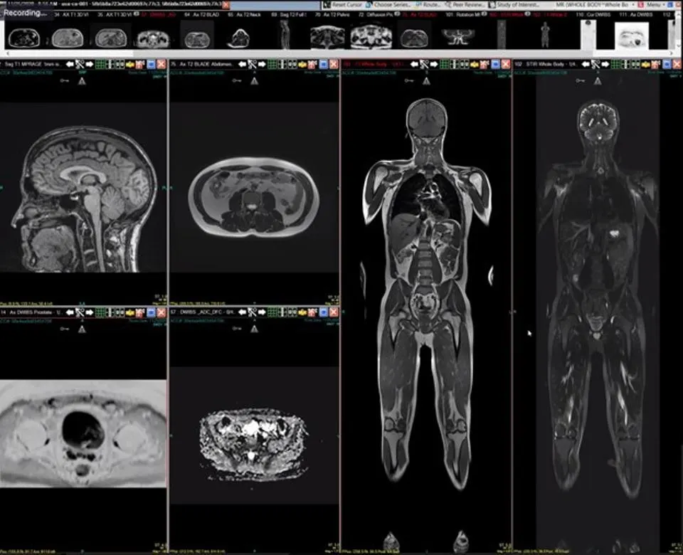 ALM DICOM Viewer Hybrid Model