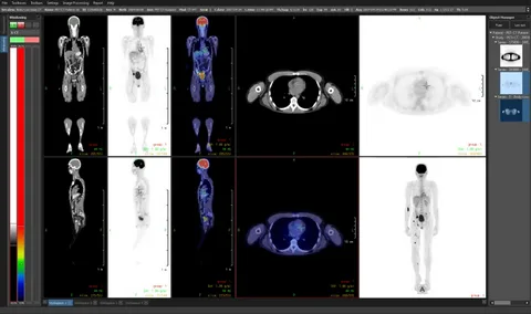 ALM DICOM Viewer Hybrid Model 1