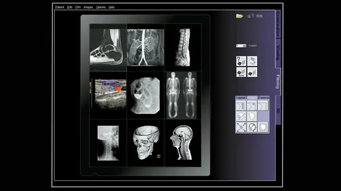 ALM DICOM Viewer Hybrid Model Work?