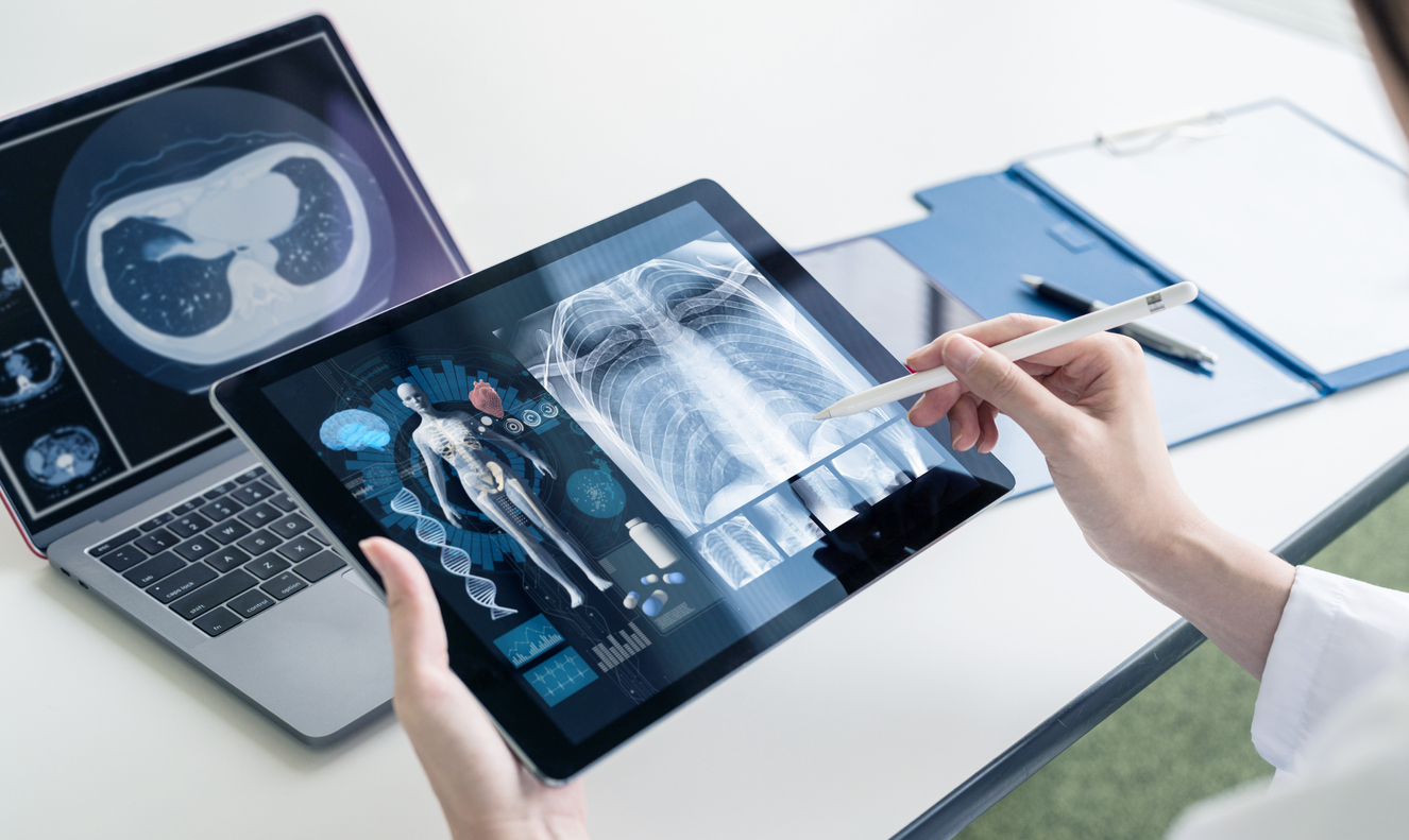 Real-World Applications of ALM Viewer Tele-Radiology
