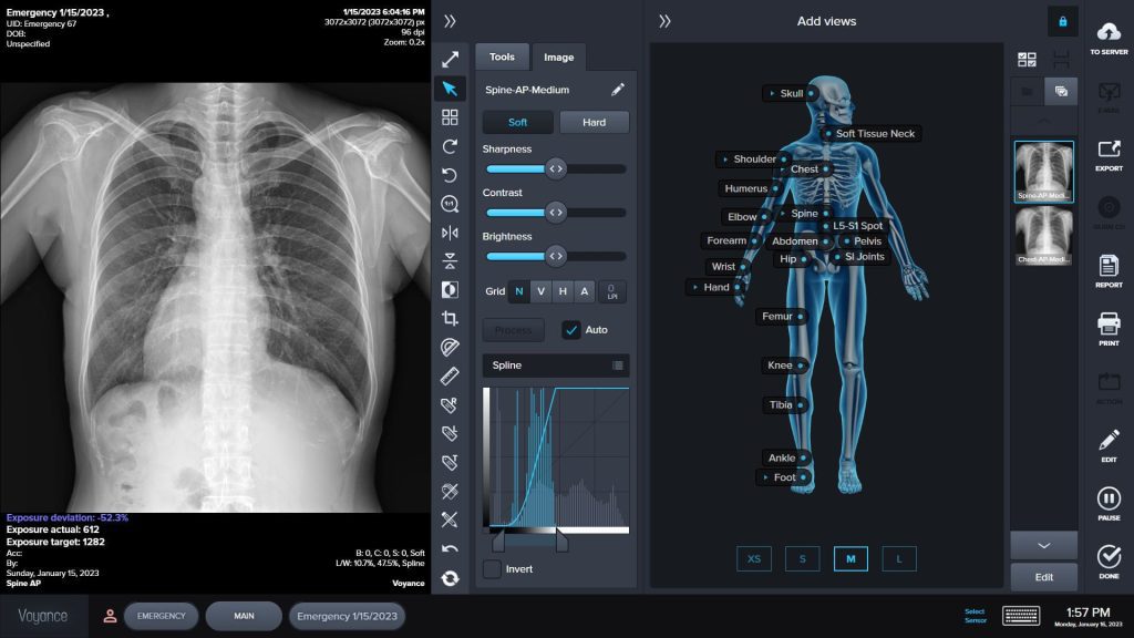 X-RAY Viewer and PACS solutions