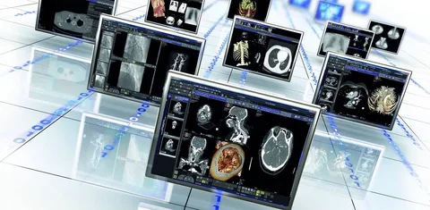 ALM DICOM Hybrid Model Features