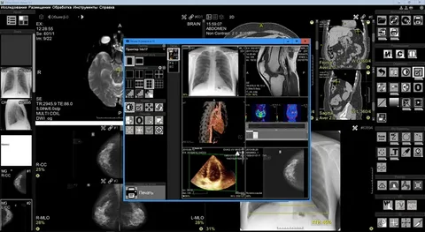 ALM DICOM Hybrid Model Features