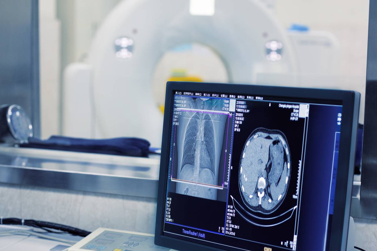 What is Tele-Radiology?