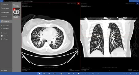 ALM Cloud & Onsite Models Workflow
