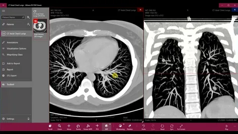 Cloud & Onsite Models Workflow with ALM DICOM