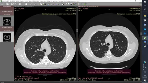 Cloud & Onsite Models Workflow ALM DICOM Viewer