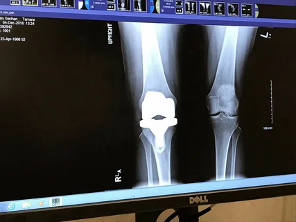 DICOM Onsite Model to Better Care