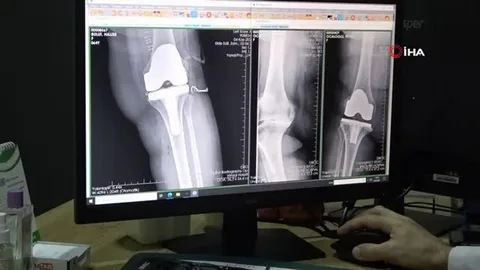 DICOM Onsite Model to Better Care