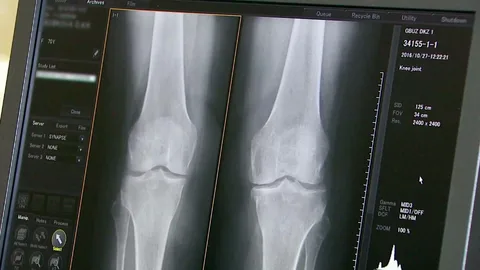 DICOM Onsite Model to Better Care