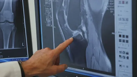 ALM DICOM Onsite Model to Better Care