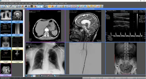  X-Ray Viewer for Mac Horo
