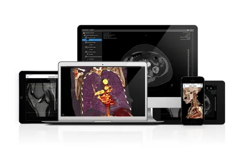 X-Ray Viewer for Mac OsiriX