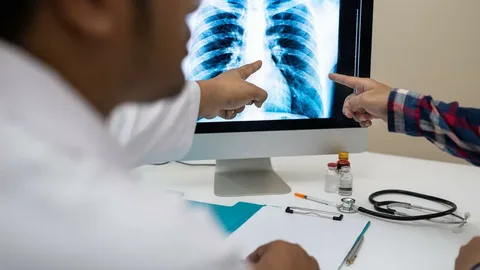 Best X-Ray Viewer for Mac